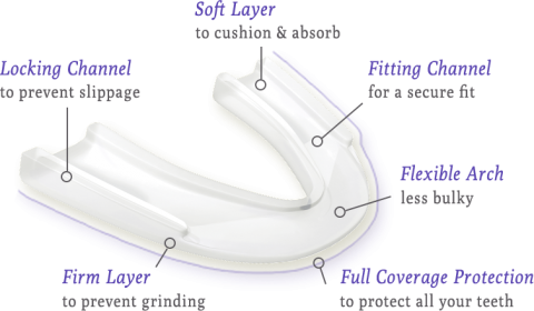 Full coverage Nightguard
